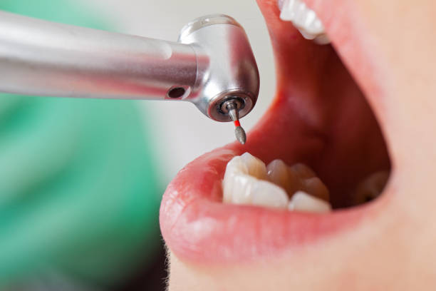 Best Knocked-Out Tooth Emergency  in Stanley, NC